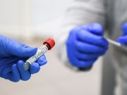 В Армении число выявленных случаев заражения COVID-19 достигло 272 356