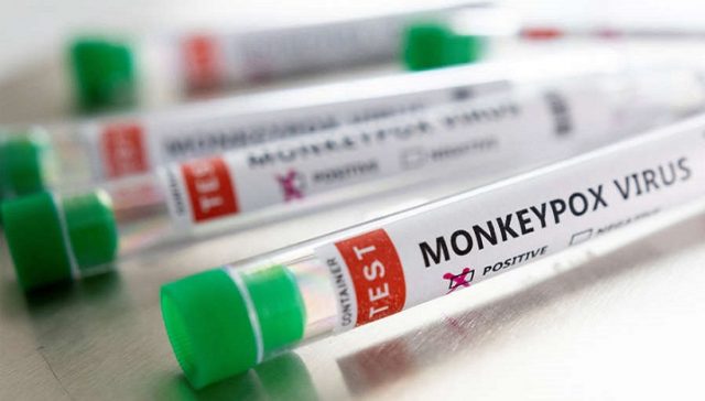 upload-2022-05-22T133954Z_364798899_RC2BCU91EQHZ_RTRMADP_3_HEALTH-MONKEYPOX-pic_32ratio_900x600-900x600-63877